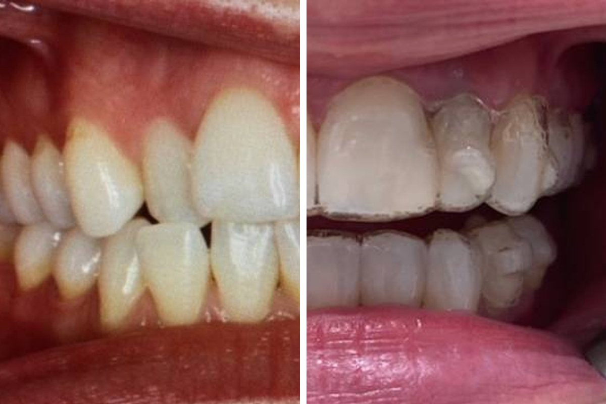 Cosmetic Dentistry at Didsbury