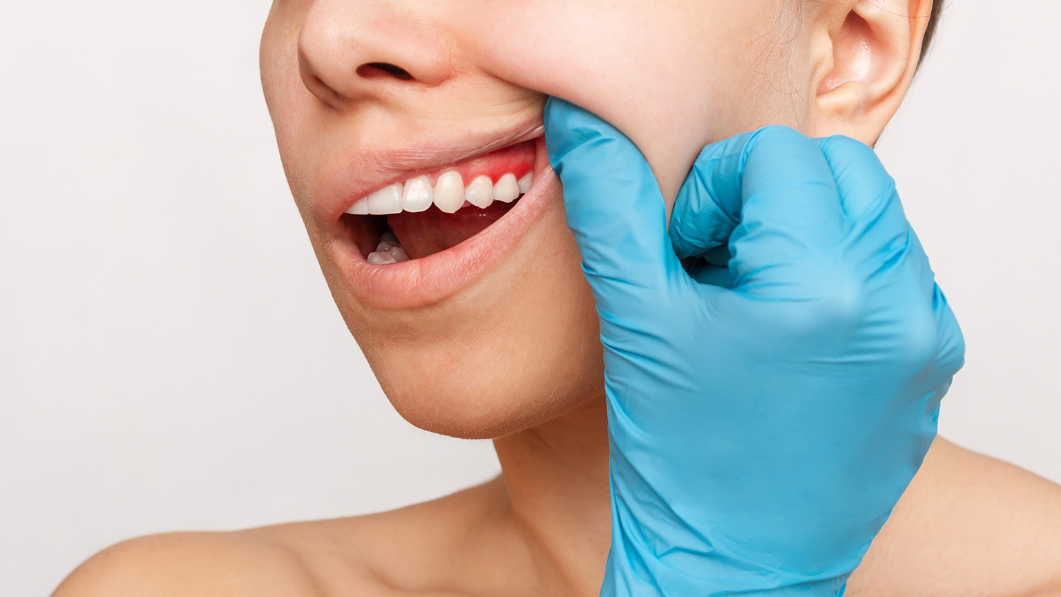 Gingivitis Symptoms, Causes, and Treatments – Dentist in Didsbury Alberta