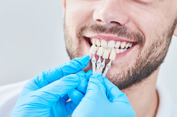 Dental Veneers